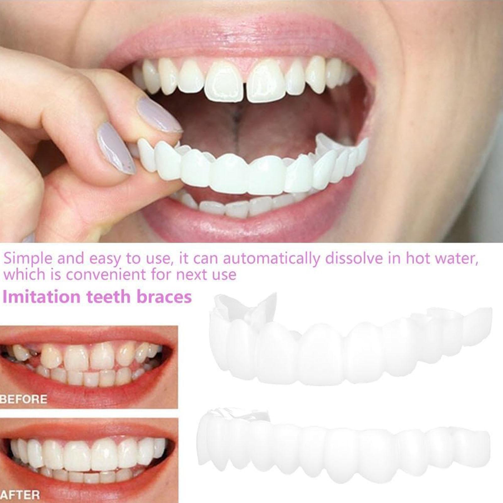Teeth Whitening Mask - 2 pz Uomo Donna Denti Temporanei