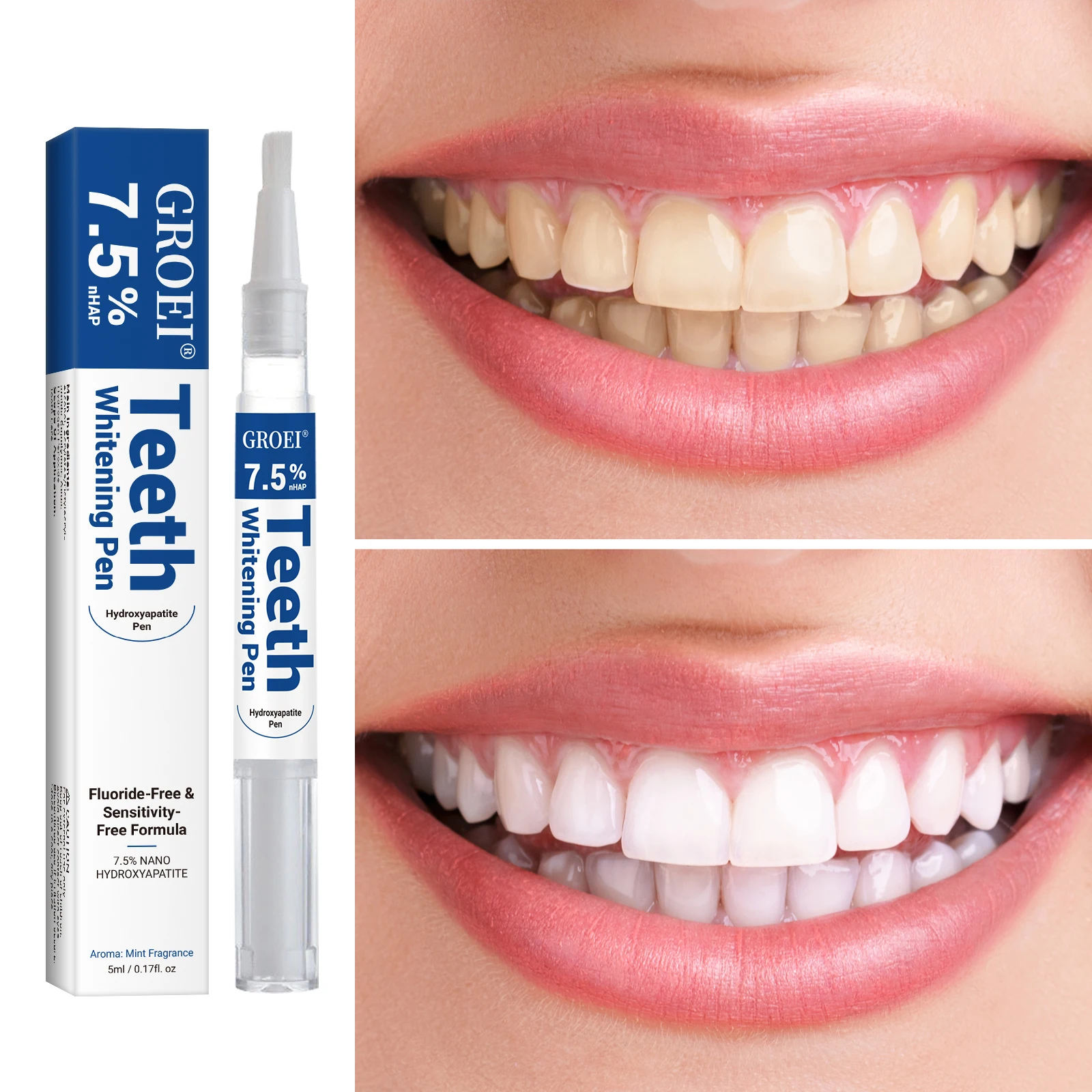Penna per sbiancamento dei den - Teeth Whitening Gel Peroxide recensione e prezzo