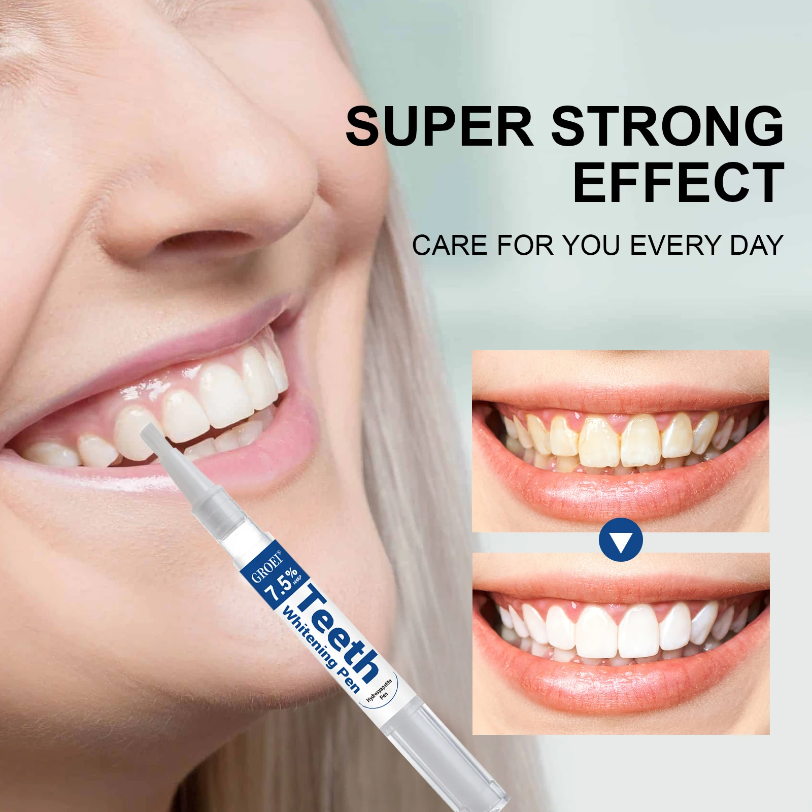 Penna per sbiancamento dei den - Teeth Whitening Gel Peroxide recensione e prezzo