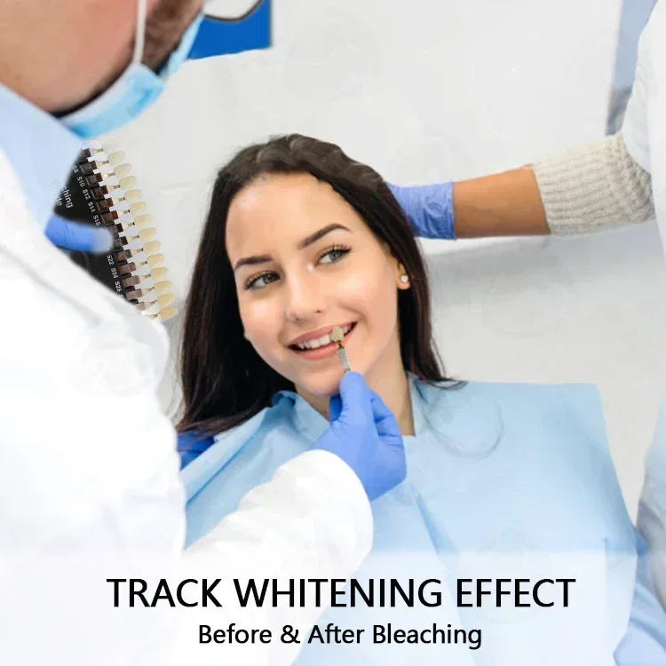 Sbiancamento dei denti profess - Teeth Whitening Shade Guide recensione e prezzo