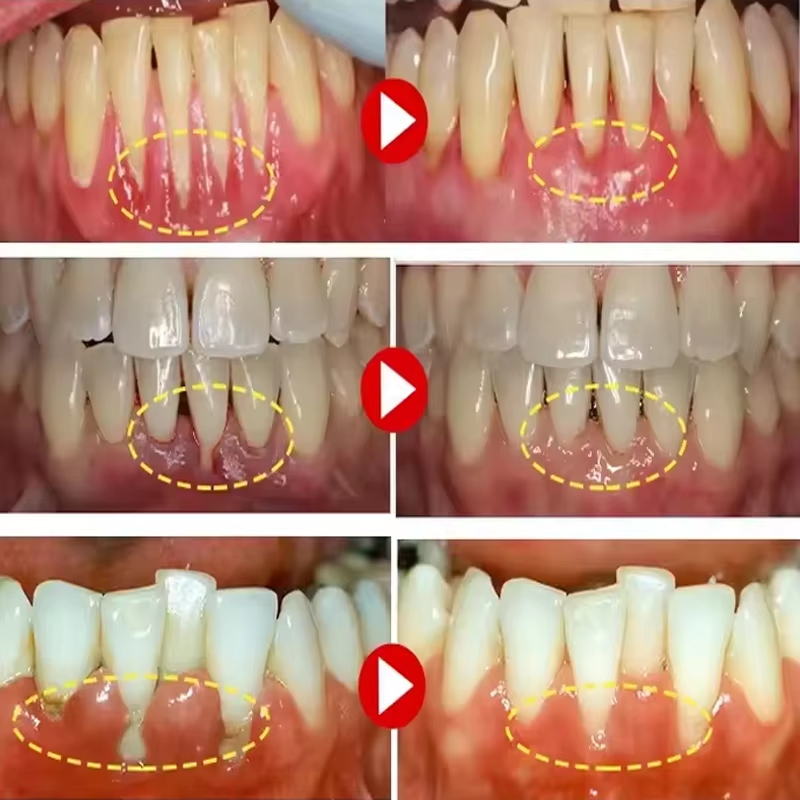 Gel Sbiancante per Denti e Rip - Teeth Whitening Gels recensione e prezzo