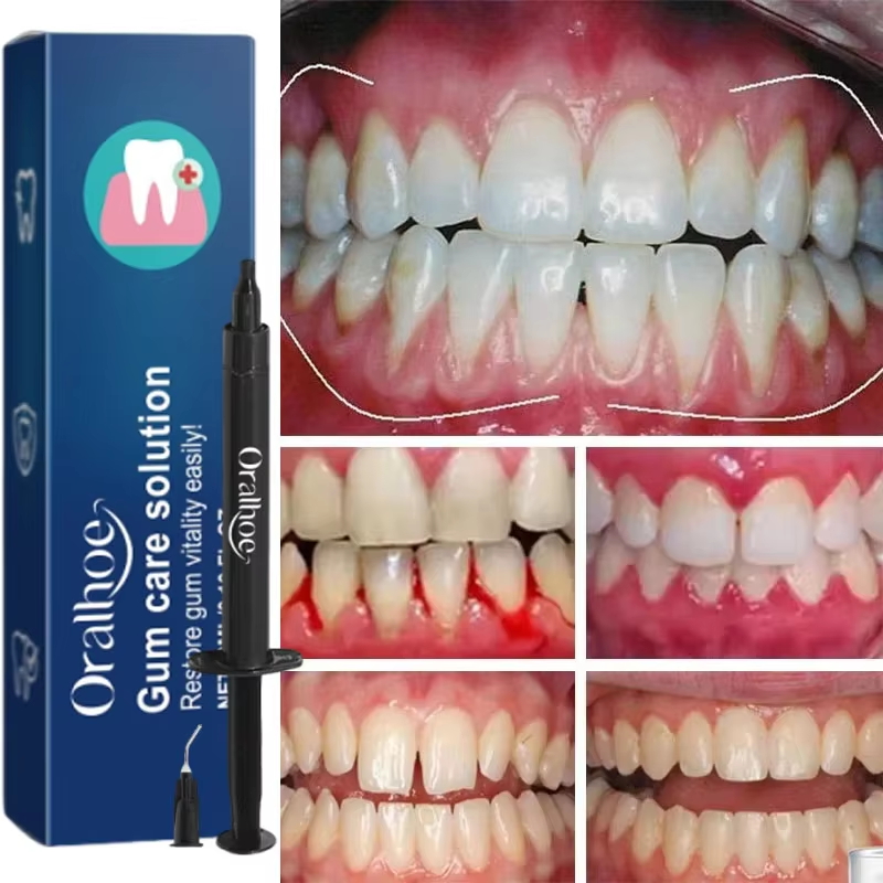 Gel Sbiancante per Denti e Rip - Teeth Whitening Gels recensione e prezzo