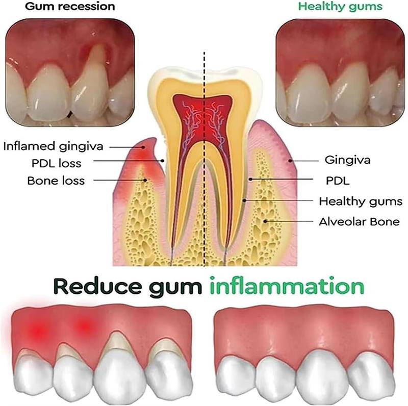 Gel Sbiancante per Denti e Rip - Teeth Whitening Gels recensione e prezzo