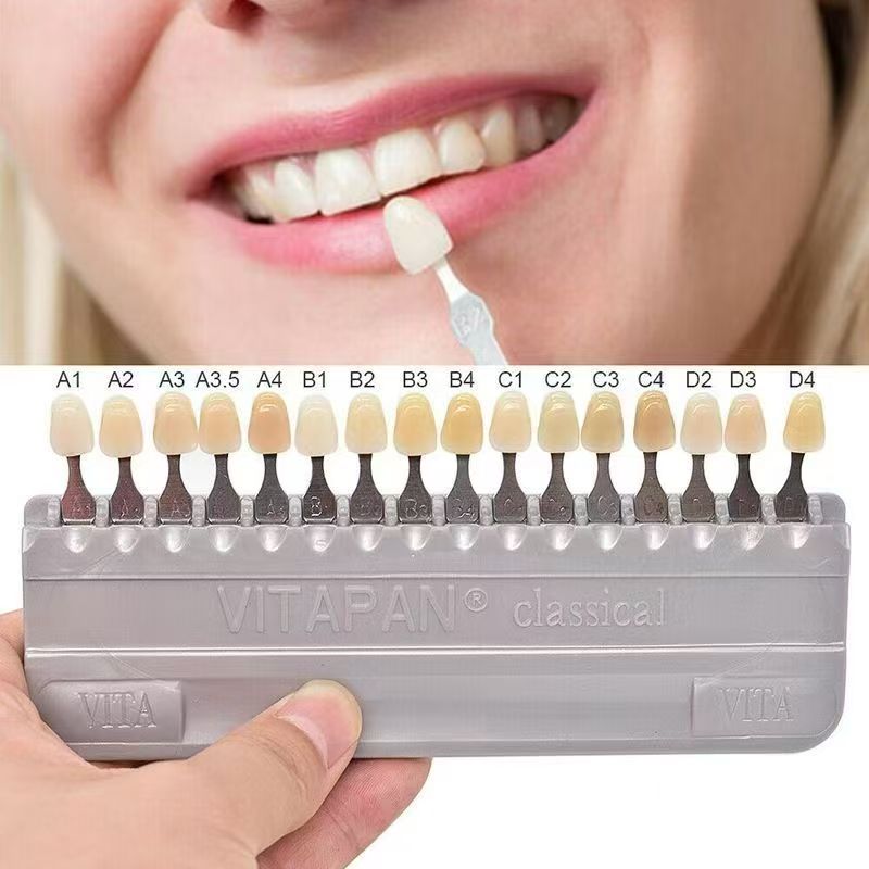 VITA 16 Colori Guida per l'omb - Teeth Whitening Shade Guide recensione e prezzo