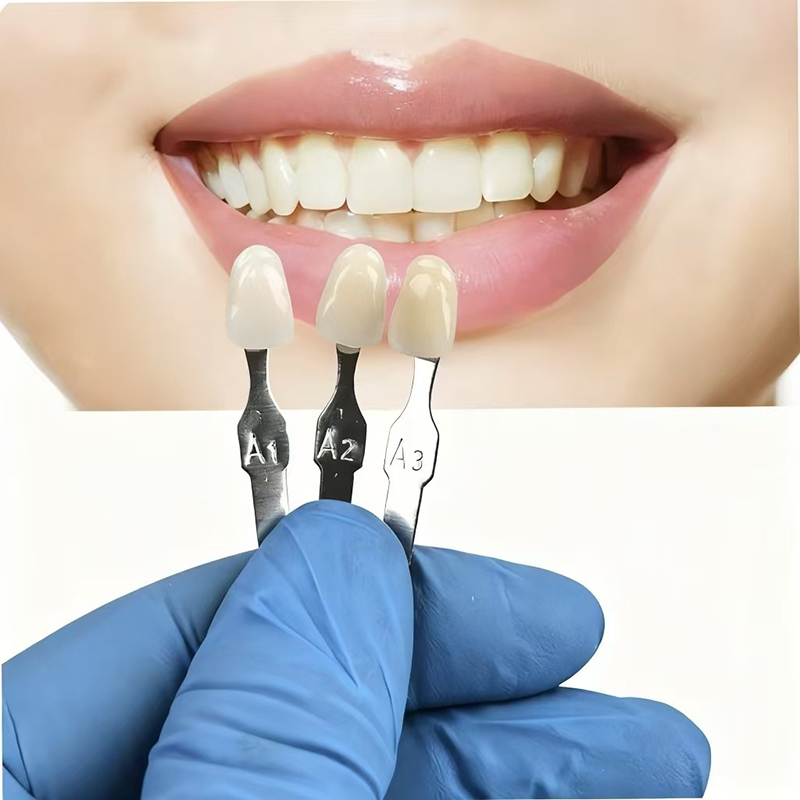 VITA 16 Colori Guida per l'omb - Teeth Whitening Shade Guide recensione e prezzo