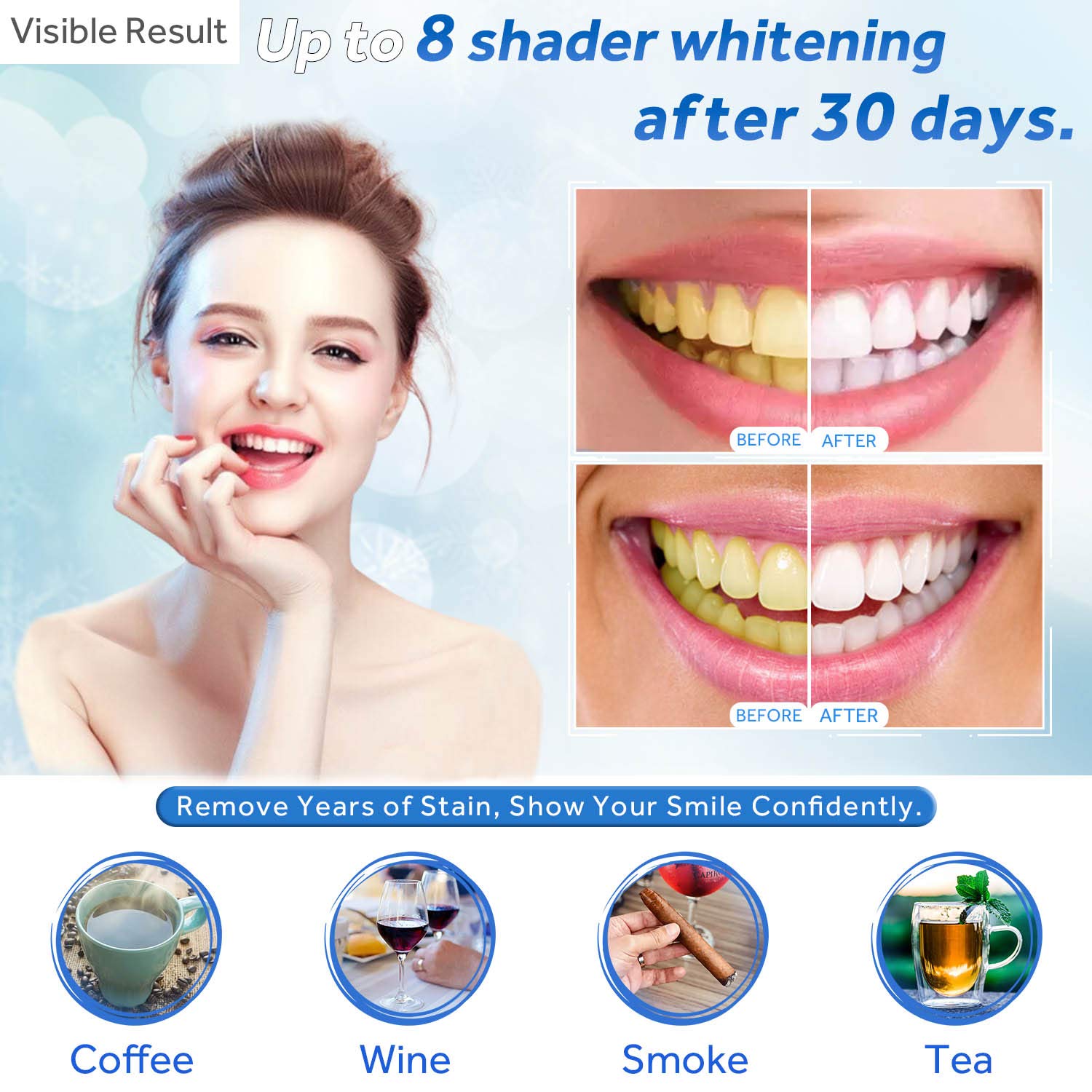 Gel sbiancante per denti Ricar - Teeth Whitening Gel Peroxide recensione e prezzo
