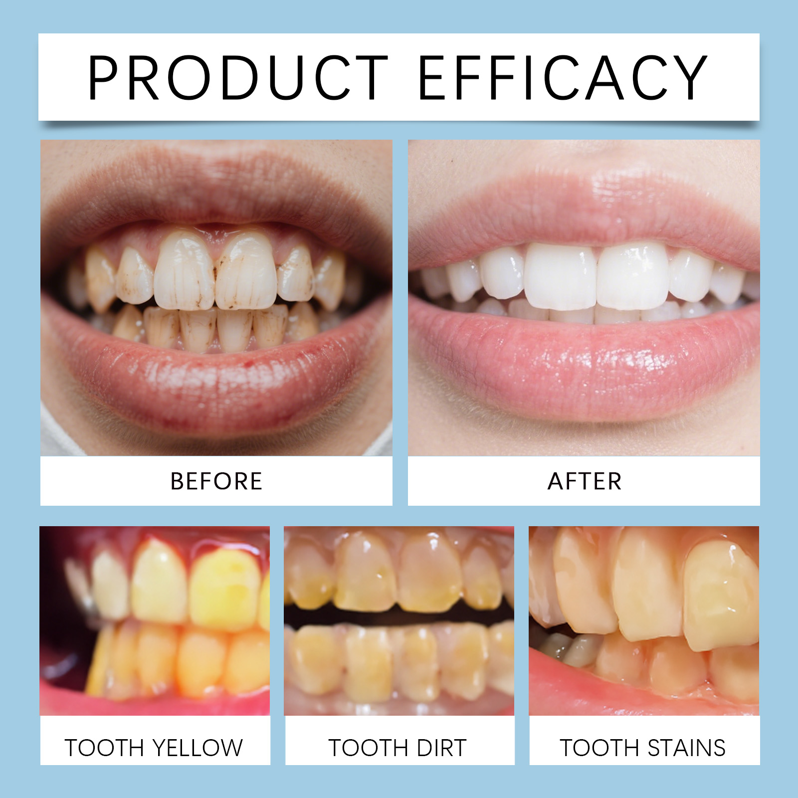 Feimuko 8ml Gel Dentifricio in - Teeth Whitening Pen recensione e prezzo