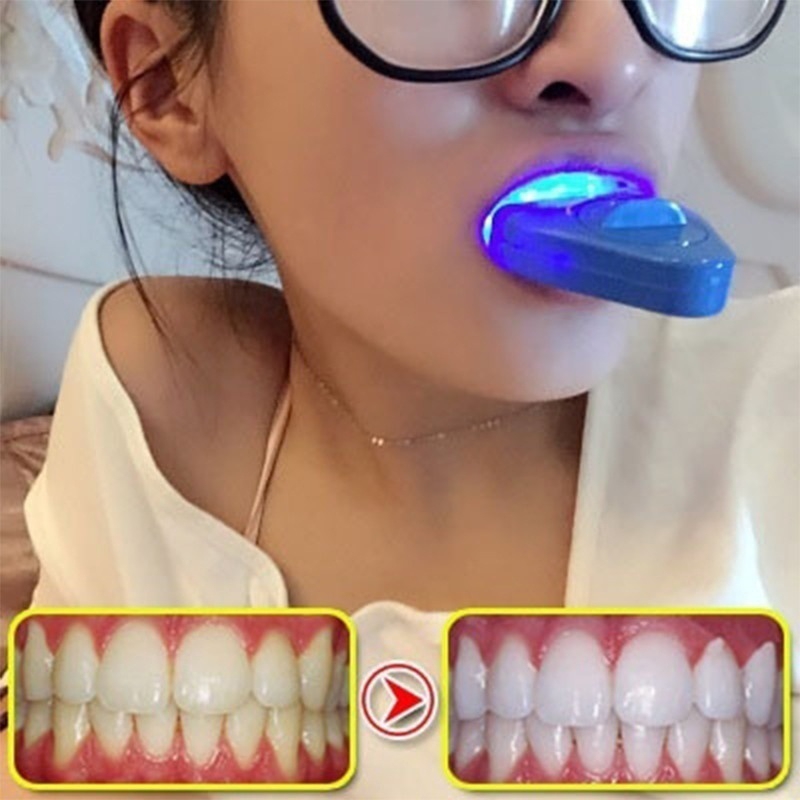 LED Sbiancamento dei denti Luc - Teeth Whitening With Laser recensione e prezzo