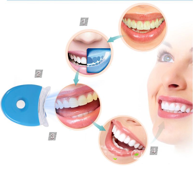 LED Sbiancamento dei denti Luc - Teeth Whitening With Laser recensione e prezzo