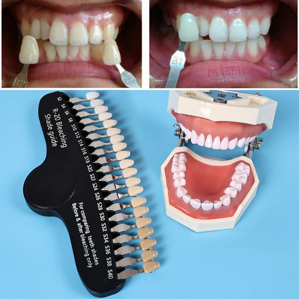 ELIJAH R-20 Guida per l'ombra  - Teeth Whitening Shade Guide recensione e prezzo
