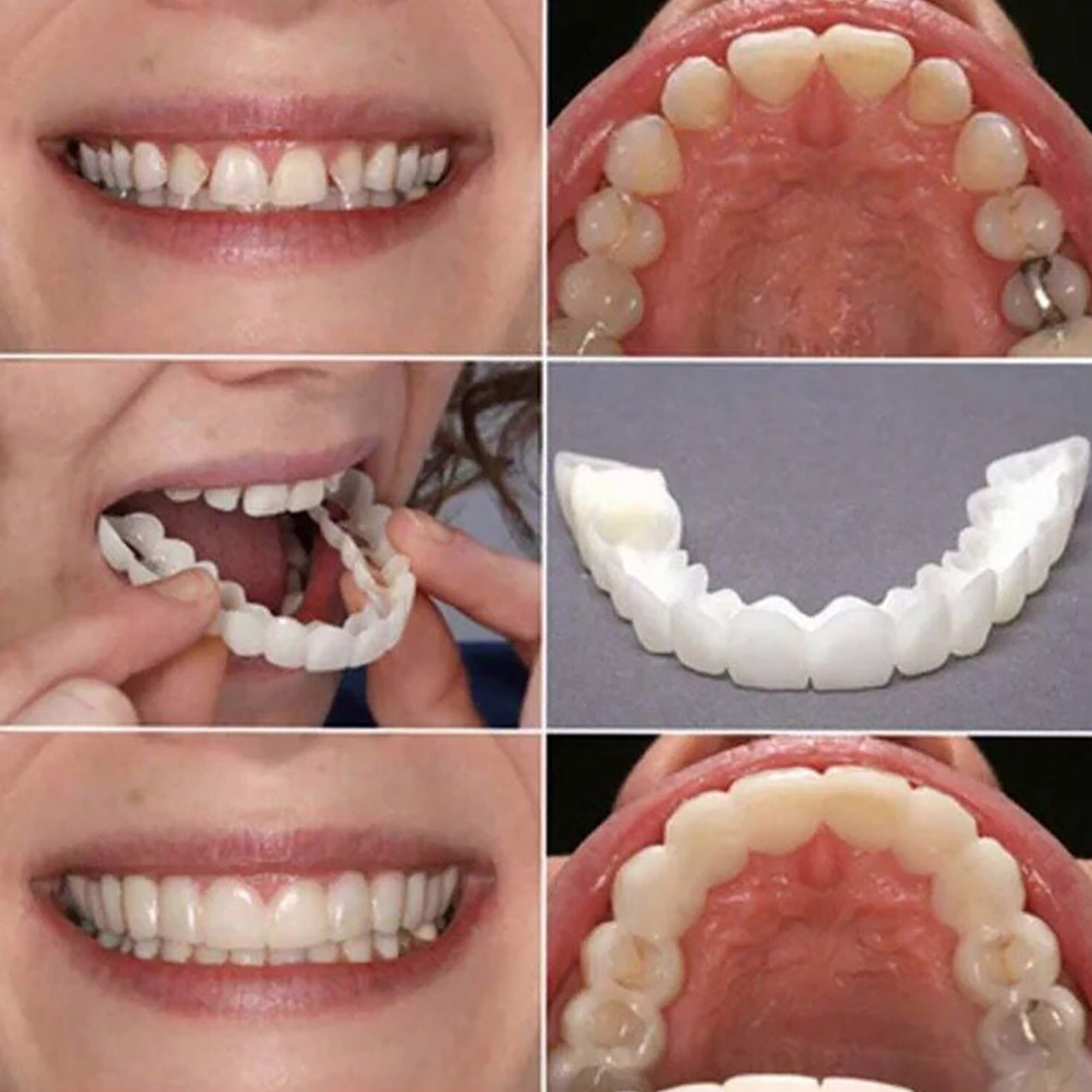 Kit di Coperture Temporanee pe - Teeth Whitening Mask recensione e prezzo
