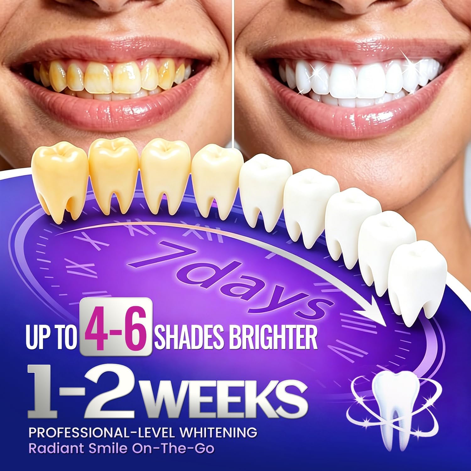 1/7 paia di strisce sbiancanti - Teeth Whitening Street recensione e prezzo