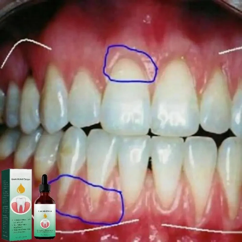 Le gocce di riparazione delle  - Teeth Whitening Paste recensione e prezzo