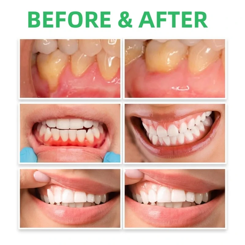 Le gocce di riparazione delle  - Teeth Whitening Paste recensione e prezzo