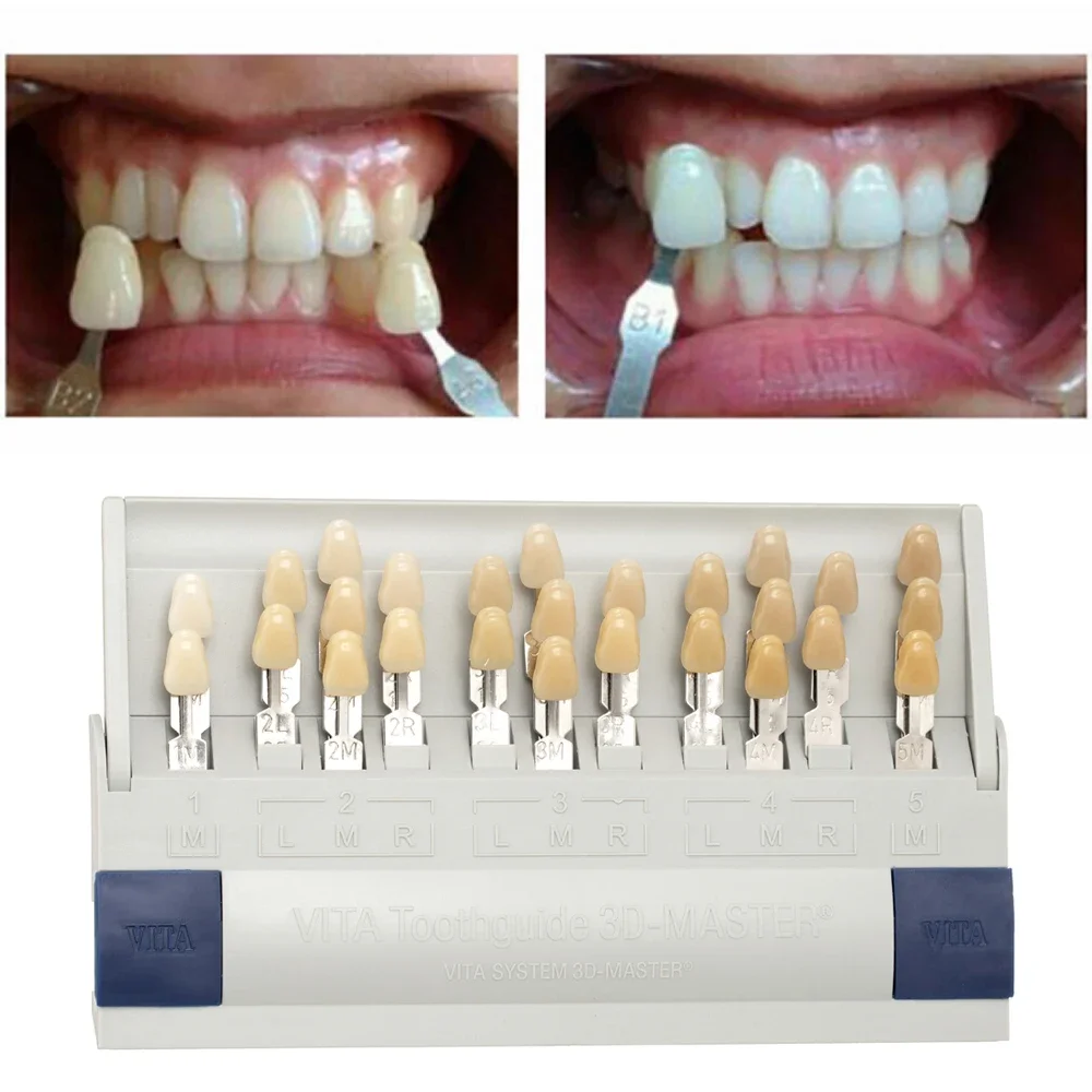Vita 3D Master Dental Lab Cand - Teeth Whitening Shade Guide recensione e prezzo