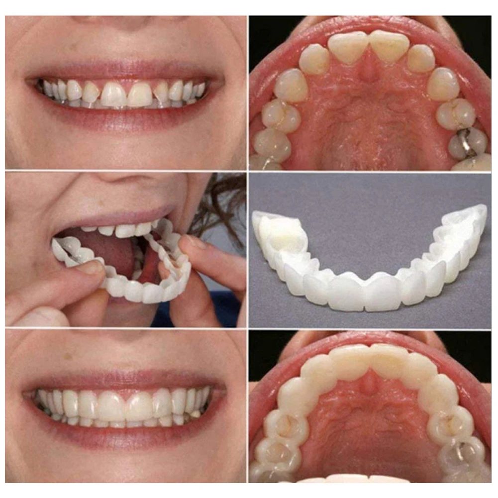 2 paia dentiere denti dentiera - Teeth Whitening Mask recensione e prezzo